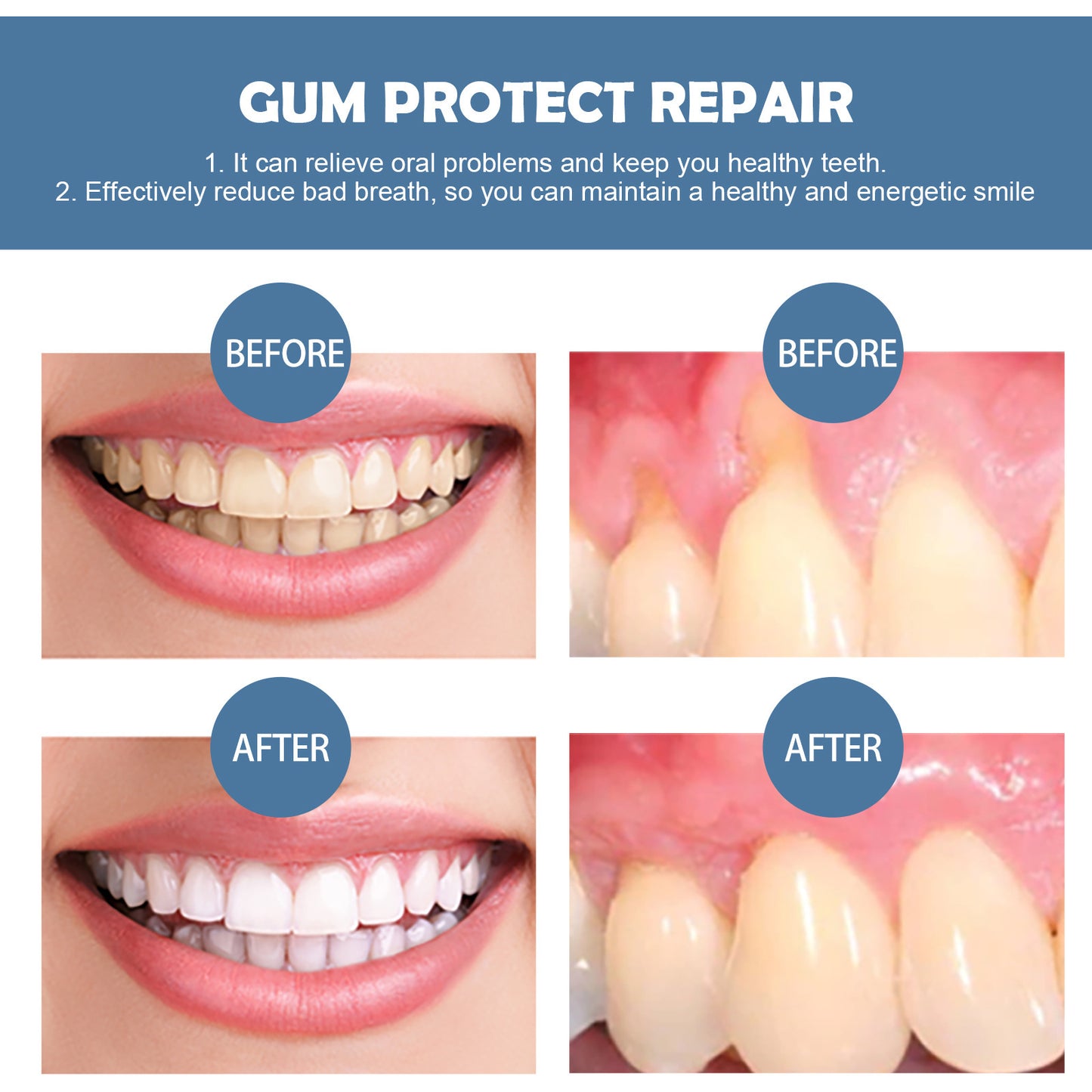 Gum Care Gel