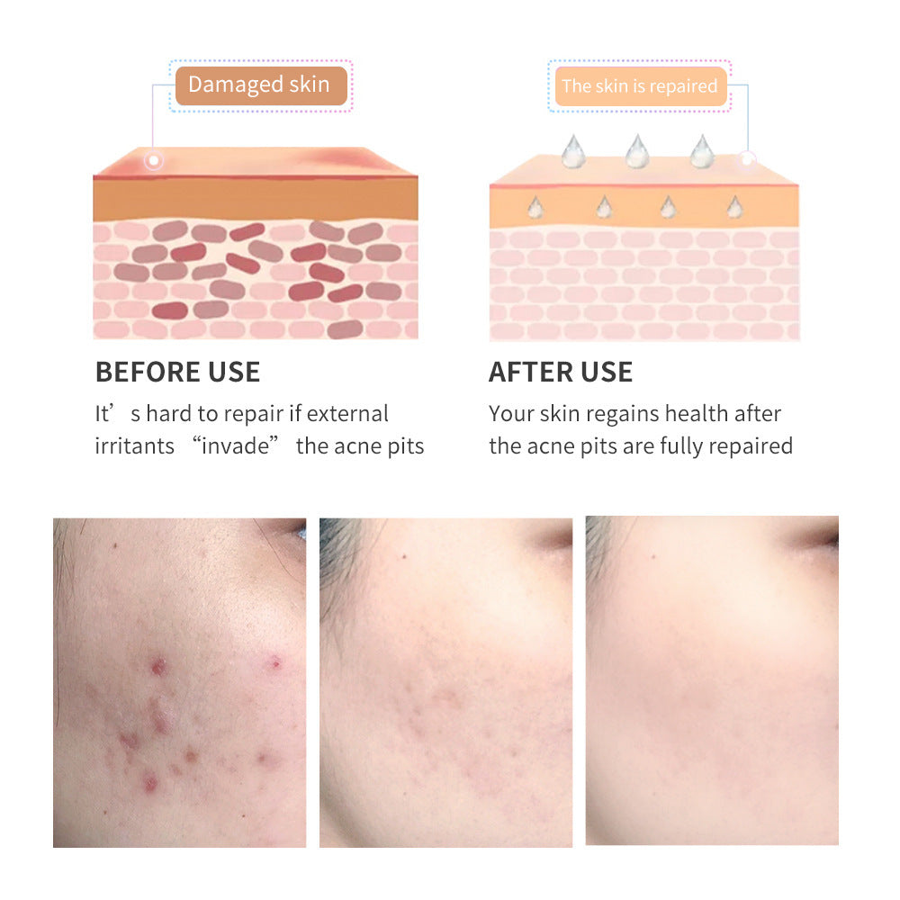 Tea Tree Scar Repair Gel