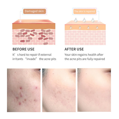 Tea Tree Scar Repair Gel