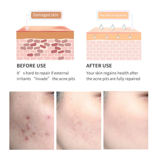 Tea Tree Scar Repair Gel